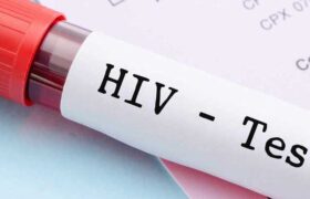 آزمایش ایدز کاملاً محرمانه انجام می‌شود