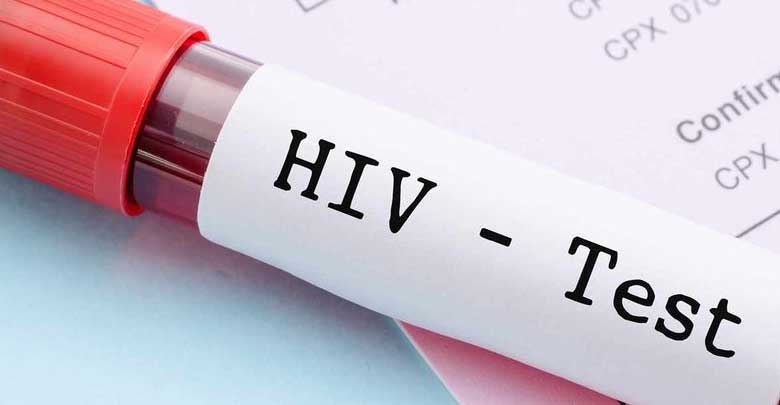 آزمایش ایدز کاملاً محرمانه انجام می‌شود