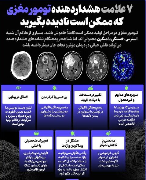 ۷ علامت هشداردهنده تومور مغزی که ممکن است نادیده بگیرید: